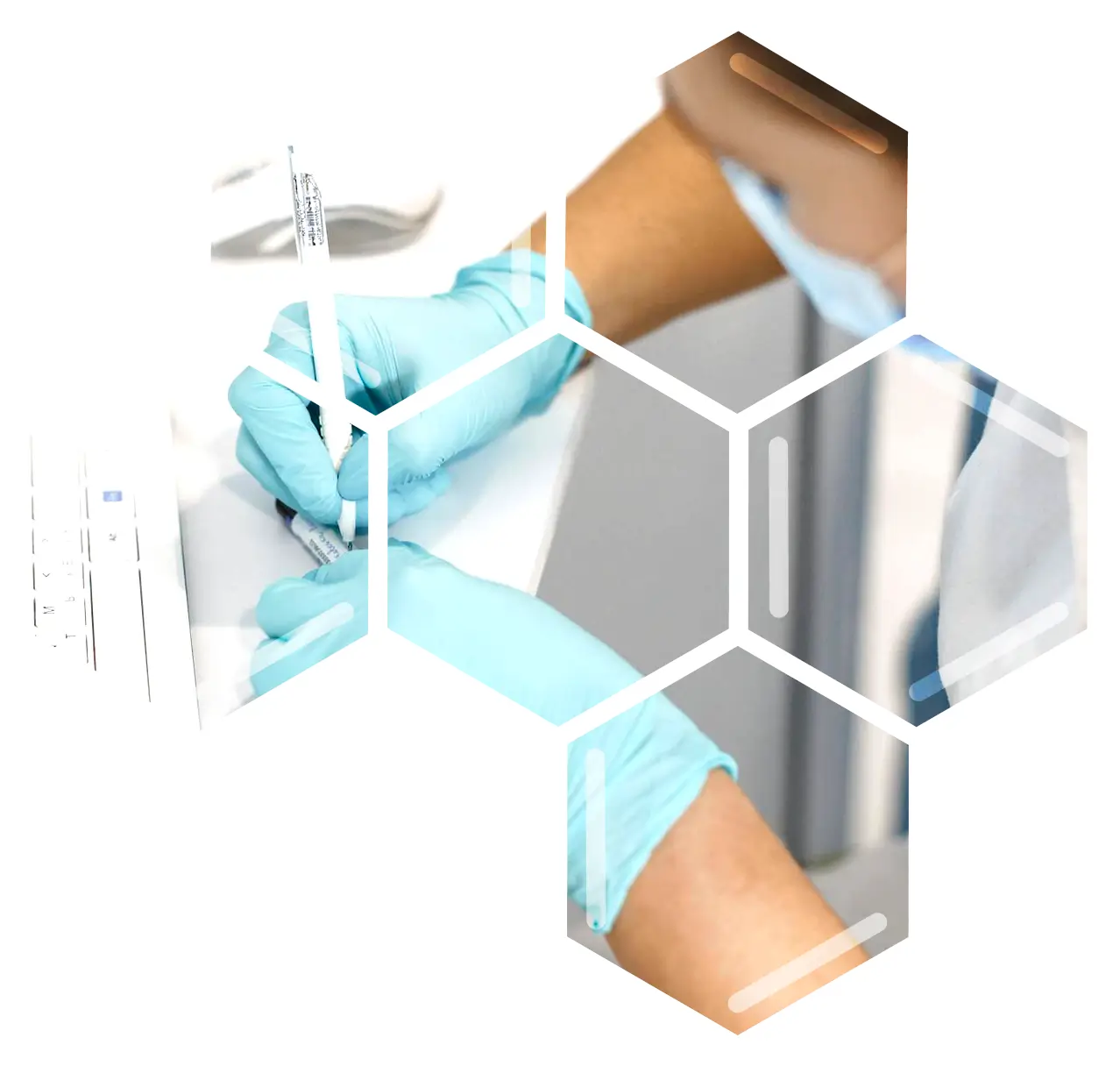 Aggregate Report Writing Services